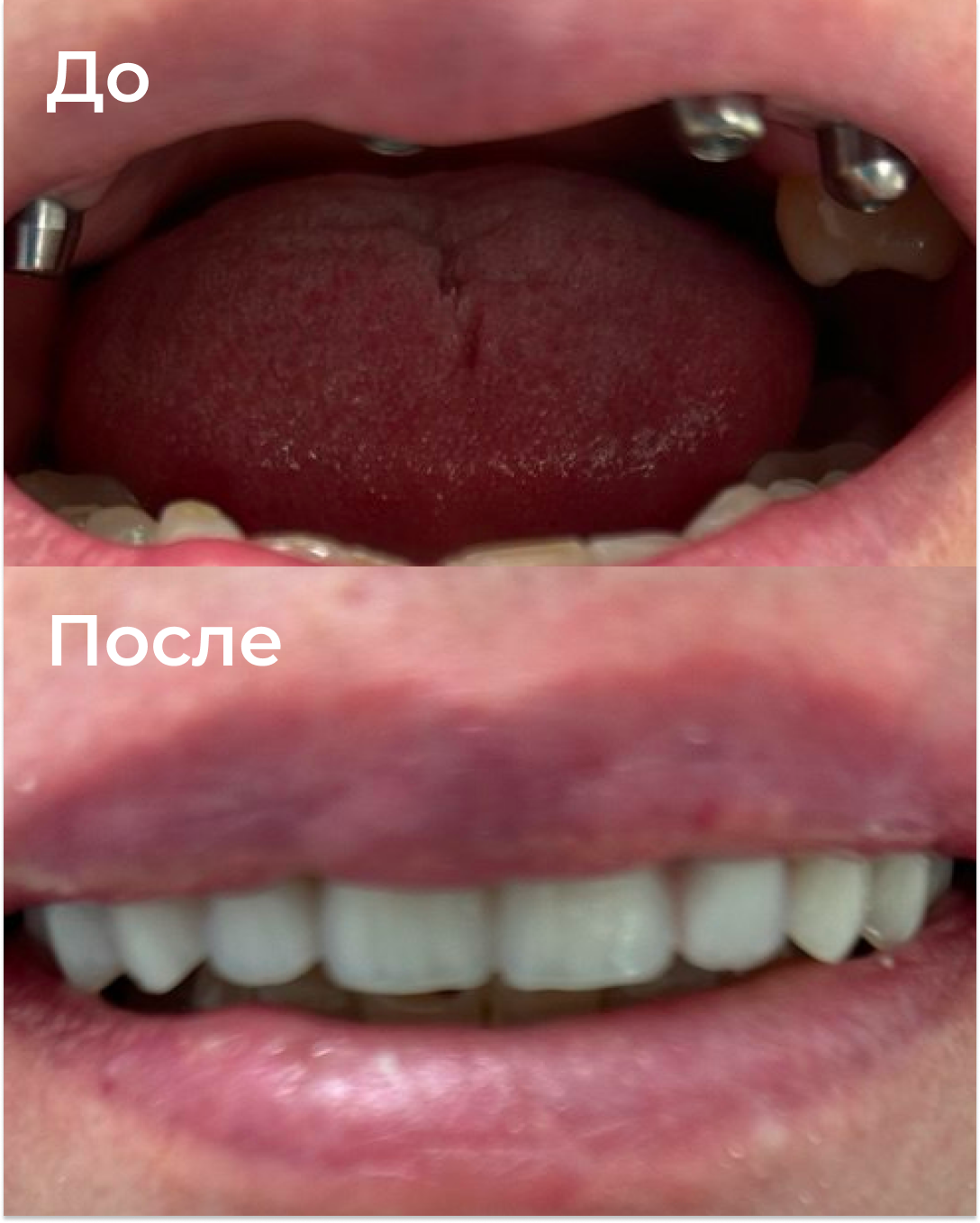 Image title